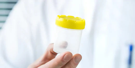 Does THCA show up on a drug test?