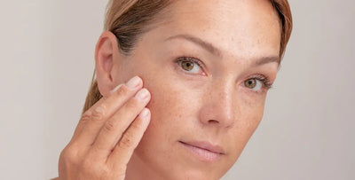 Sun Spots on Skin: Causes and Prevention